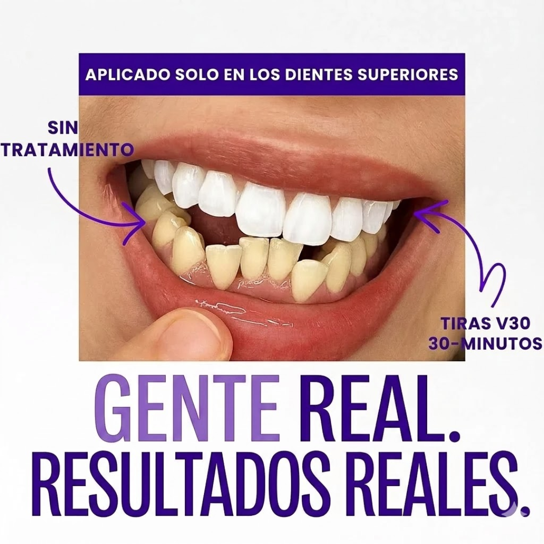 Bandas blanqueadoras Whitening Pro™