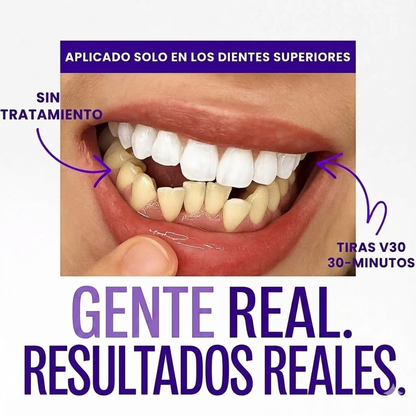 Bandas blanqueadoras Whitening Pro™